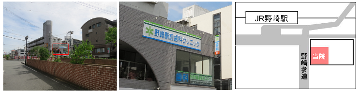 大阪大東市のノンクラスプデンチャーは野崎駅前歯科クリニック